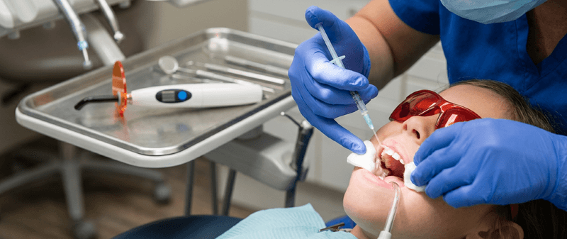 Dental Sealants Mississauga | No-Drill Molar Protection at North Star Dentistry Dental sealant application on a child's molar at North Star Dentistry in Mississauga — hygienist applying protective resin coating to prevent cavities
