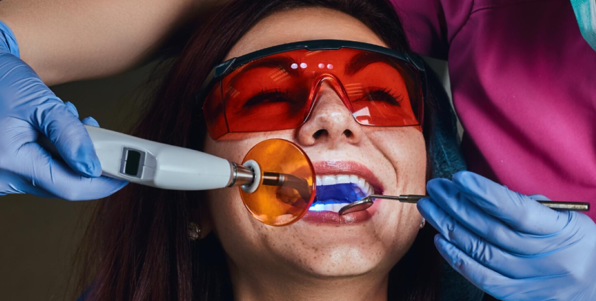 Tooth fillings procedure at North Star Dentistry Mississauga — a patient wearing protective orange glasses receives a composite resin filling using a curing light in a modern dental operatory